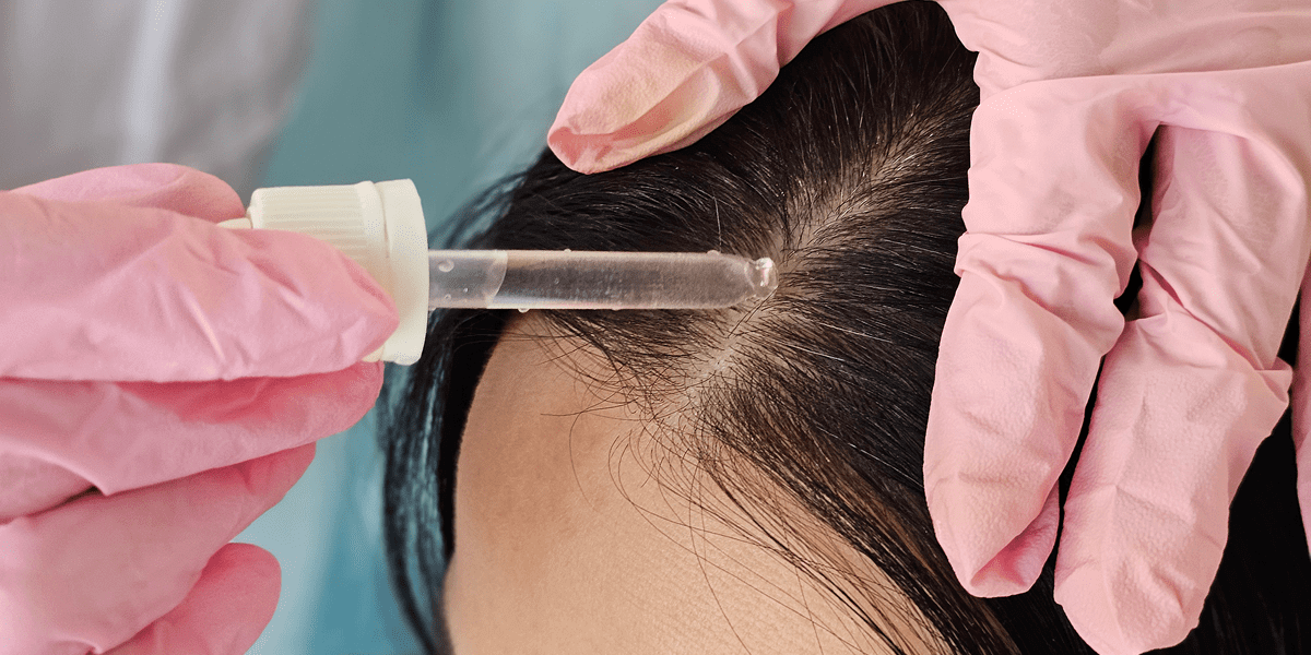 Applying hair serum with dropper on scalp.